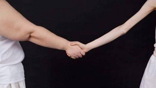Διατροφικές διαταραχές, τύποι, αίτια, αντιμετώπιση