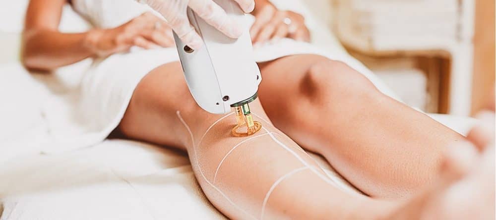 Αποτρίχωση Laser: Όσα πρέπει να γνωρίζεις πριν ξεκινήσεις