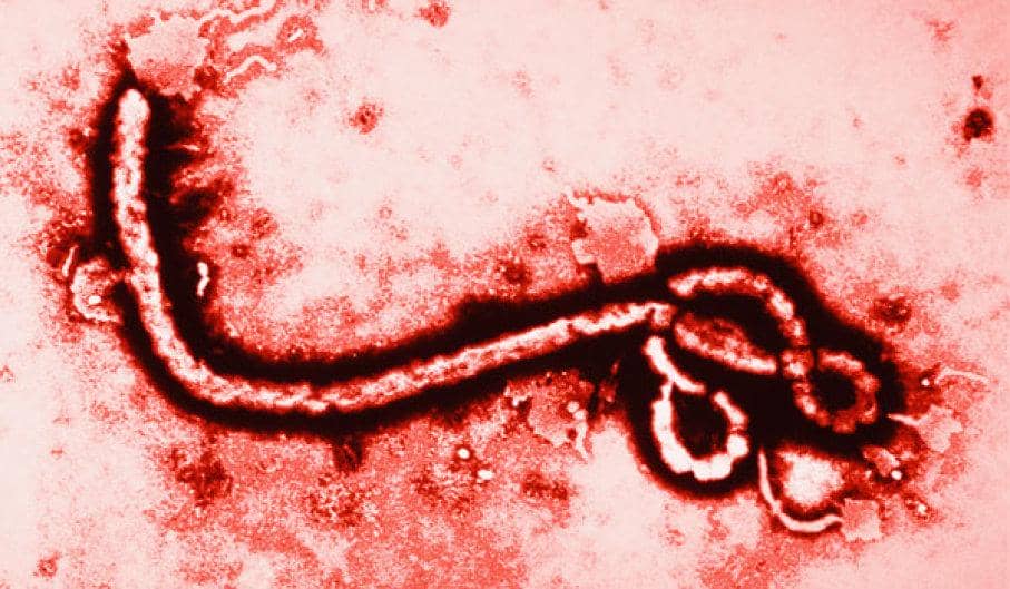 Μολυσματικός ιός (Ebola virus)