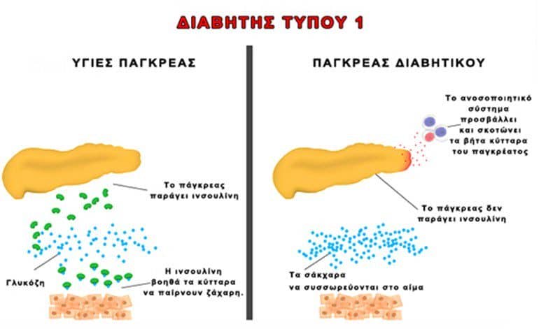 κύτταρα παγκρέατος