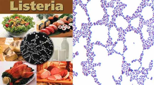 Listeria monocytogenes