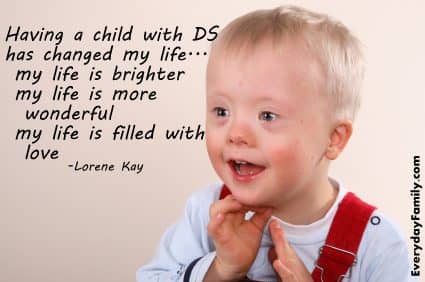 syndrome down